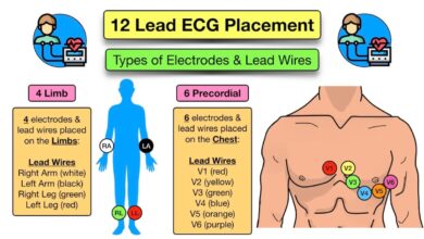 leads for ekg